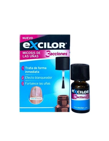 EXCILOR MICOSIS DE LAS UÑAS 3 ACCIONES SOLUCION 7 ml